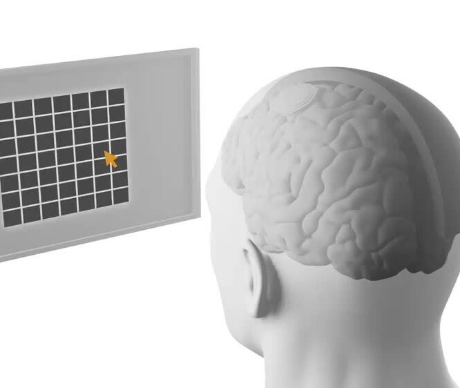 Coming to a brain near you a tiny computer wsj