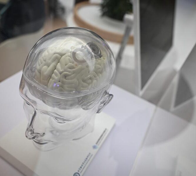 Chinas brain computer interface innovation in fast lane news cgtn com