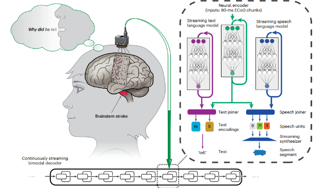Mind reading brain implant continuously streams thoughts through speaker live science