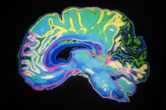 Brain computer interface based neurofeedback training enables transferable control of cortical state switching in humans pnas